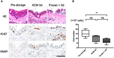 Temporary Storage of the Human Nasal Tissue and Cell Sheet for Wound Repair